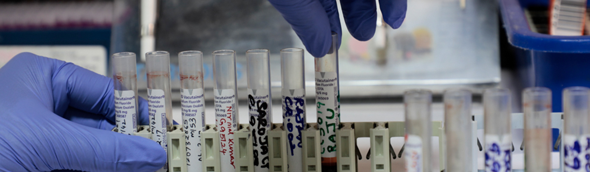 Image of vaccine samples Image of vaccine samples